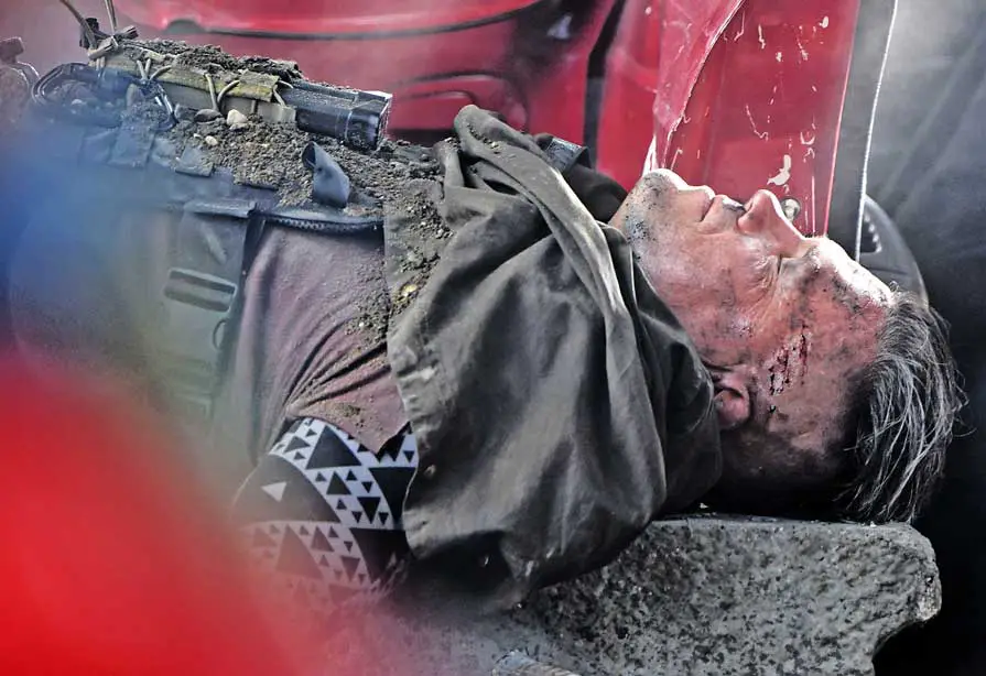Deadpool 2 Filming Vancouver Josh Brolin Cable Scars