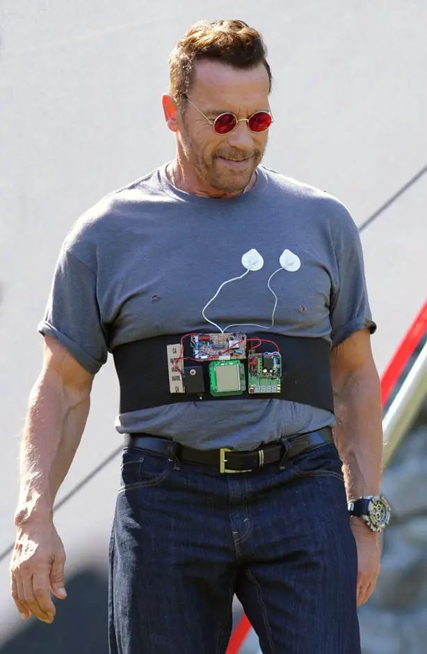 Arnold Schwarzenegger Open Heart surgery