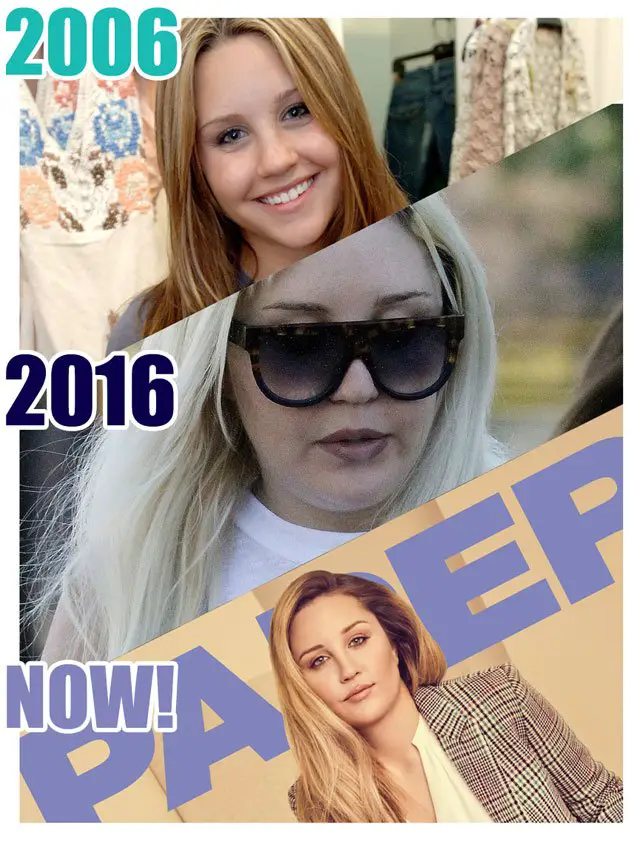 Amanda Bynes’ Incredible Before and After Photos 😮 📷 • Celebrity WotNot